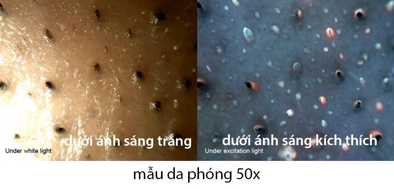 Ứng dụng của Dino-Lite AM4115T-CFVW trong da liễu Ứng dụng của Dino-Lite AM4115T-CFVW trong da liễu